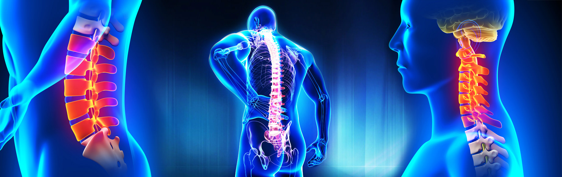 Orlex / Efamed Orthopedics
